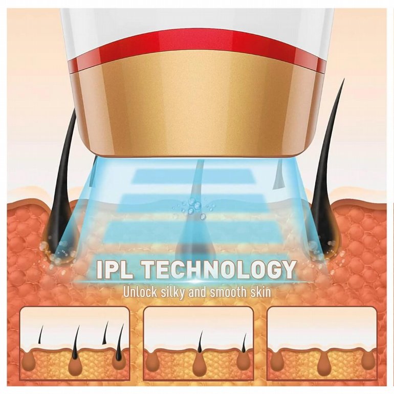 ����� ���� ����� ���� Medics Care IPL MC1280 | ��������� 